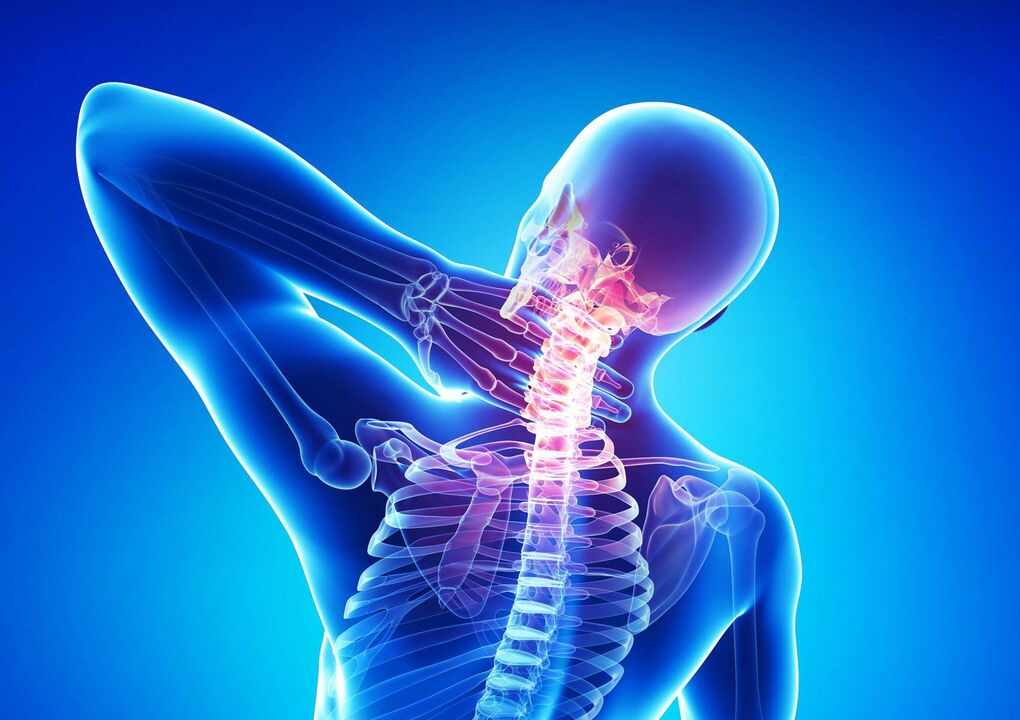 The neck osteochondrosis