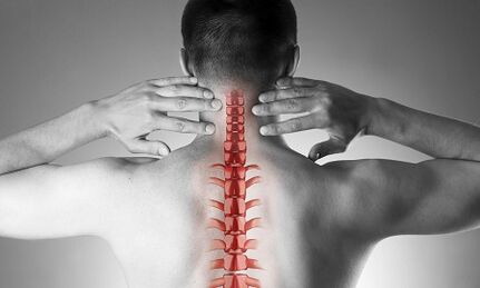 How is osteochondrosis of the cervical spine manifested