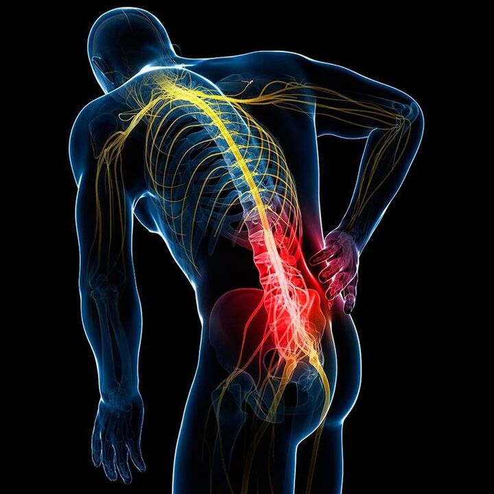 caused by back pain